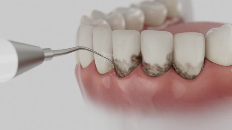 Reliable Dental contractor in Gypsum, CO by Dentist Open Now